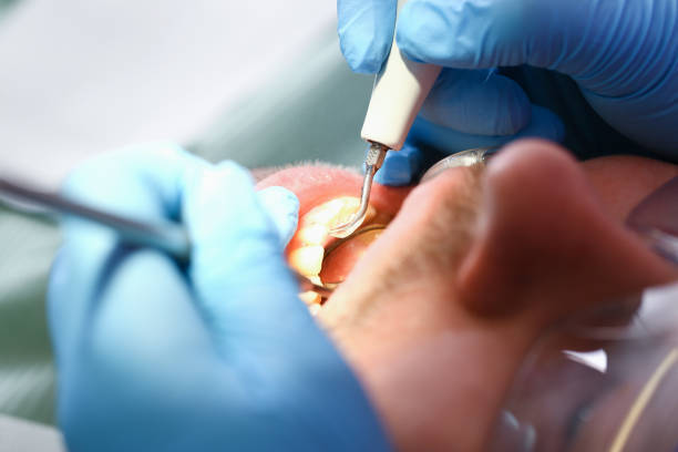 Best Emergency Dental Care for Abscessed Tooth in Orange Grove, TX