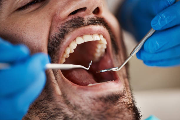 Best Orthodontic Emergency Dentist in Orange Grove, TX