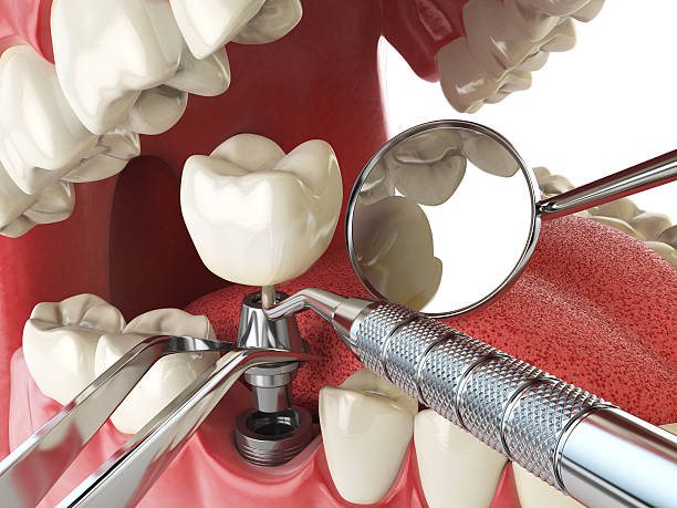 Best Emergency Dental Services for Seniors in Orange Grove, TX